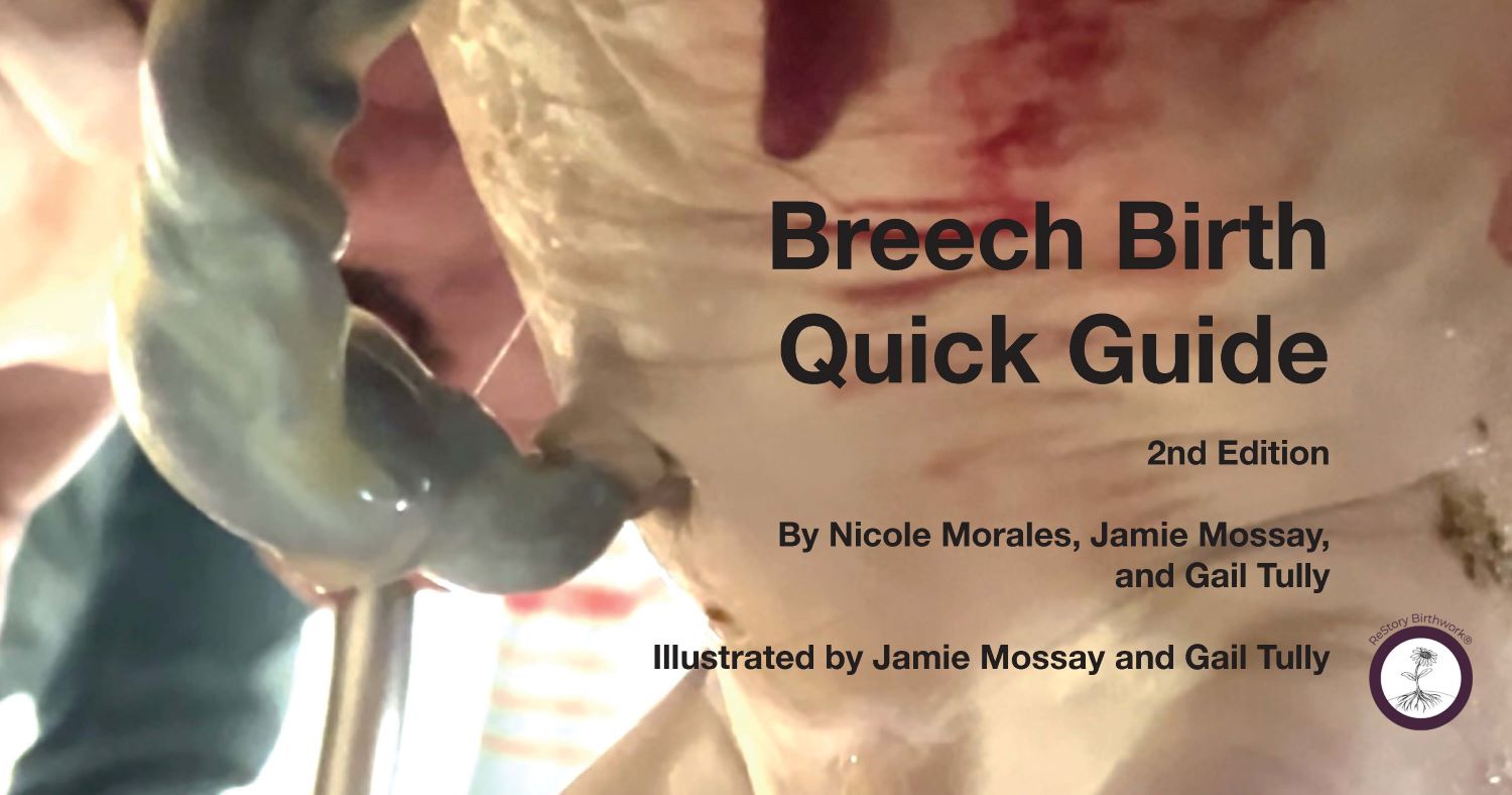Breech Birth Quick Guide (2nd Edition)